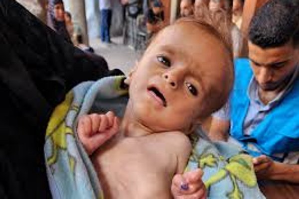 Gaza: The Silence That Chokes Us All