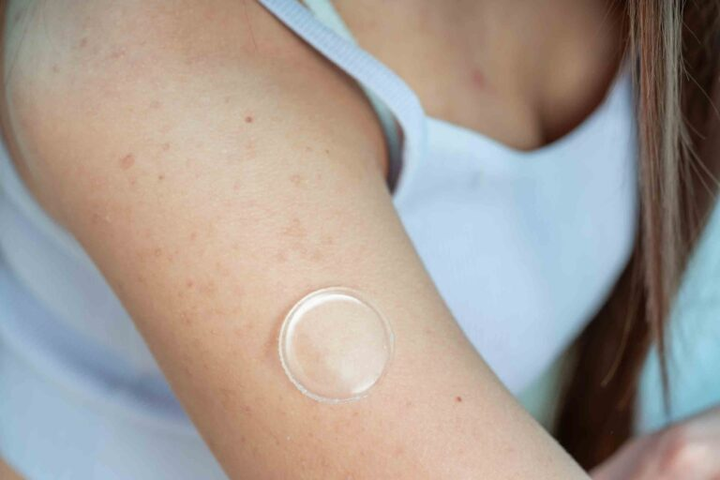 Close-up of a sensor patch on an upper arm