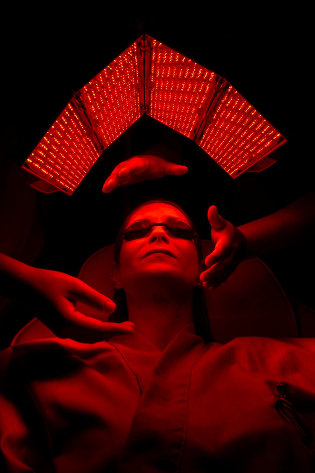 Protocolo de fototerapia en Ōpalo