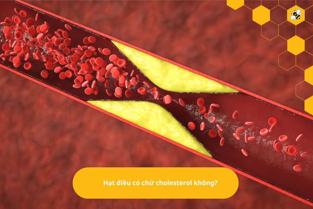 Hạt điều có chứ cholesterol không?