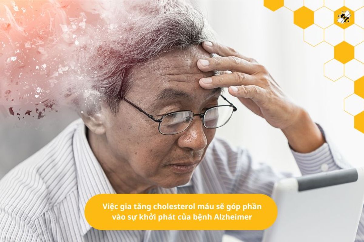 Việc gia tăng cholesterol máu sẽ góp phần vào sự khởi phát của bệnh Alzheimer