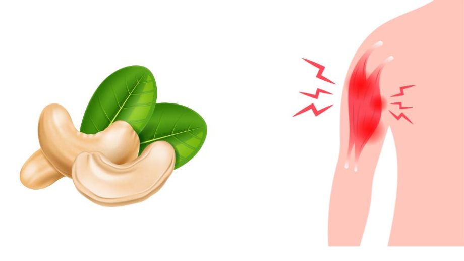 Tác dụng của hạt điều đến tình trạng viêm của cơ thể