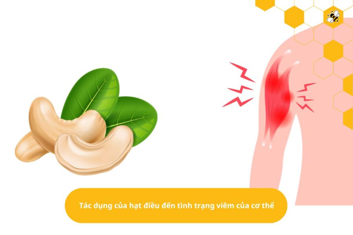 Tác dụng của hạt điều đến tình trạng viêm của cơ thể
