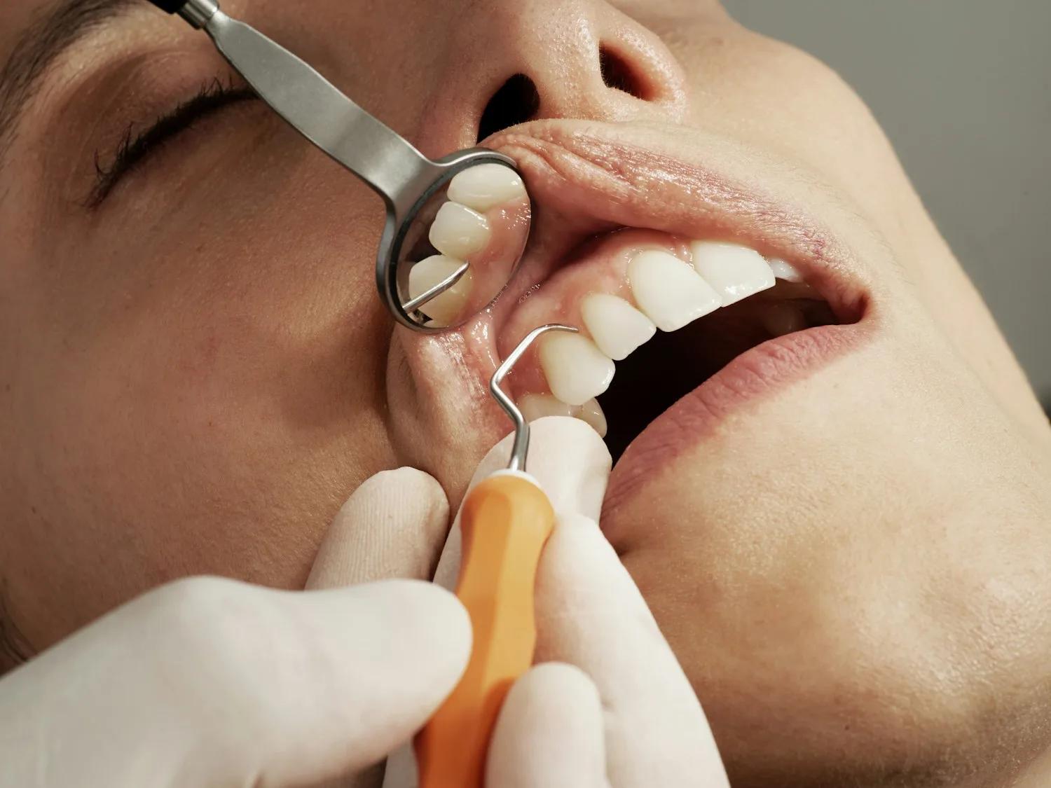 Detalle de evaluación dental, imagen provisional