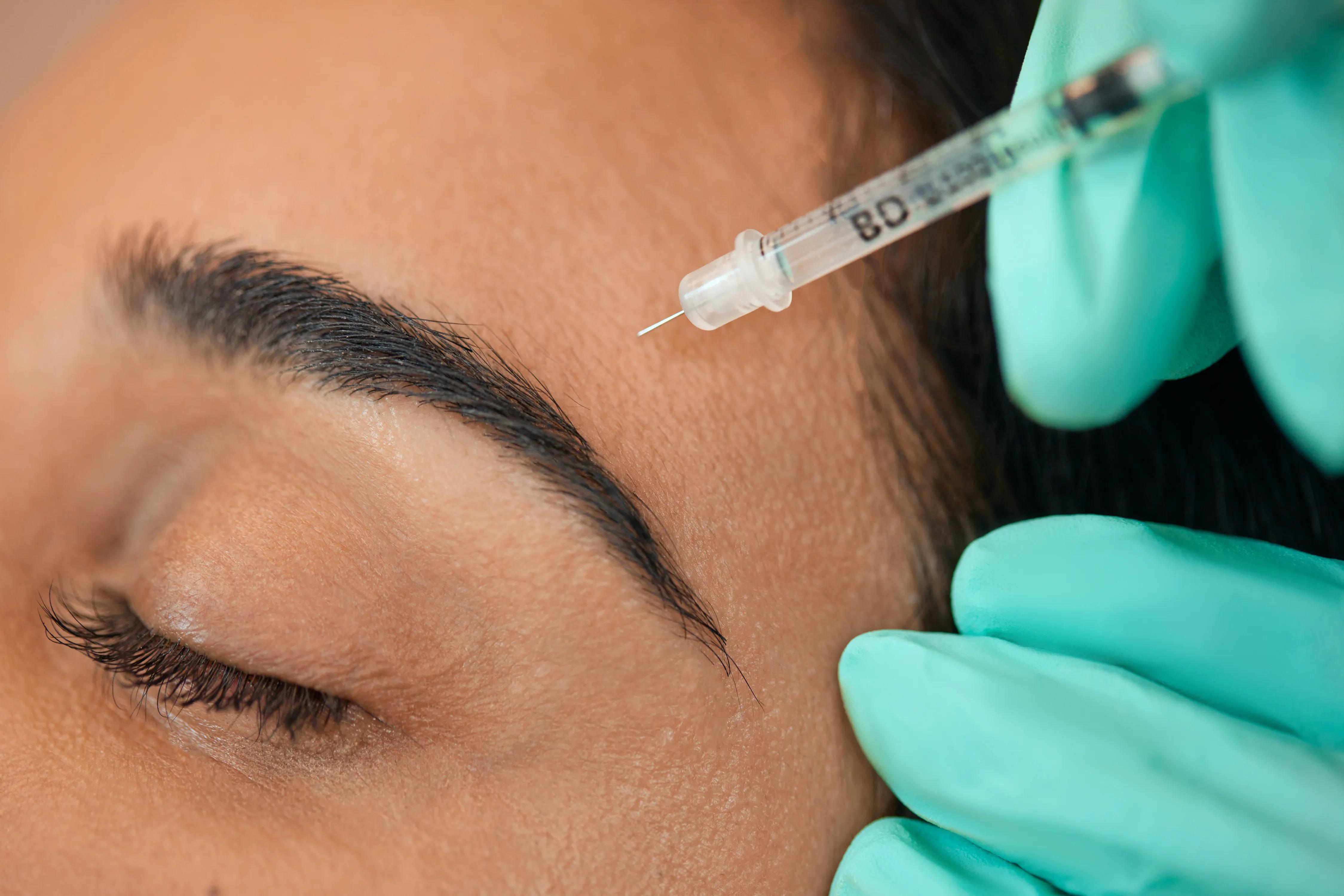 Botox for Migraines & TMJ: A Solution for Pain Relief