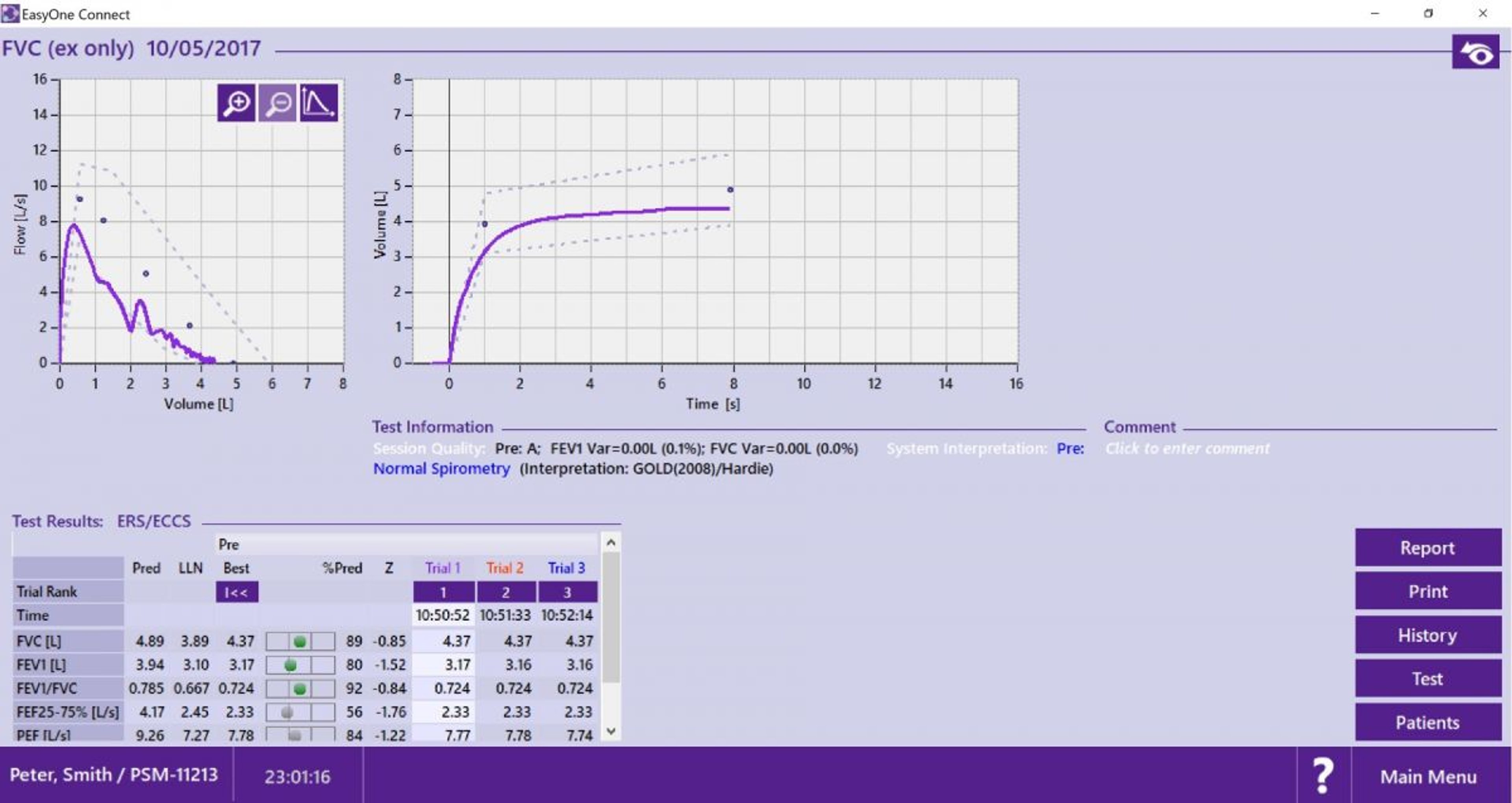 ndd Easy on-PC Spirometer Package - 4