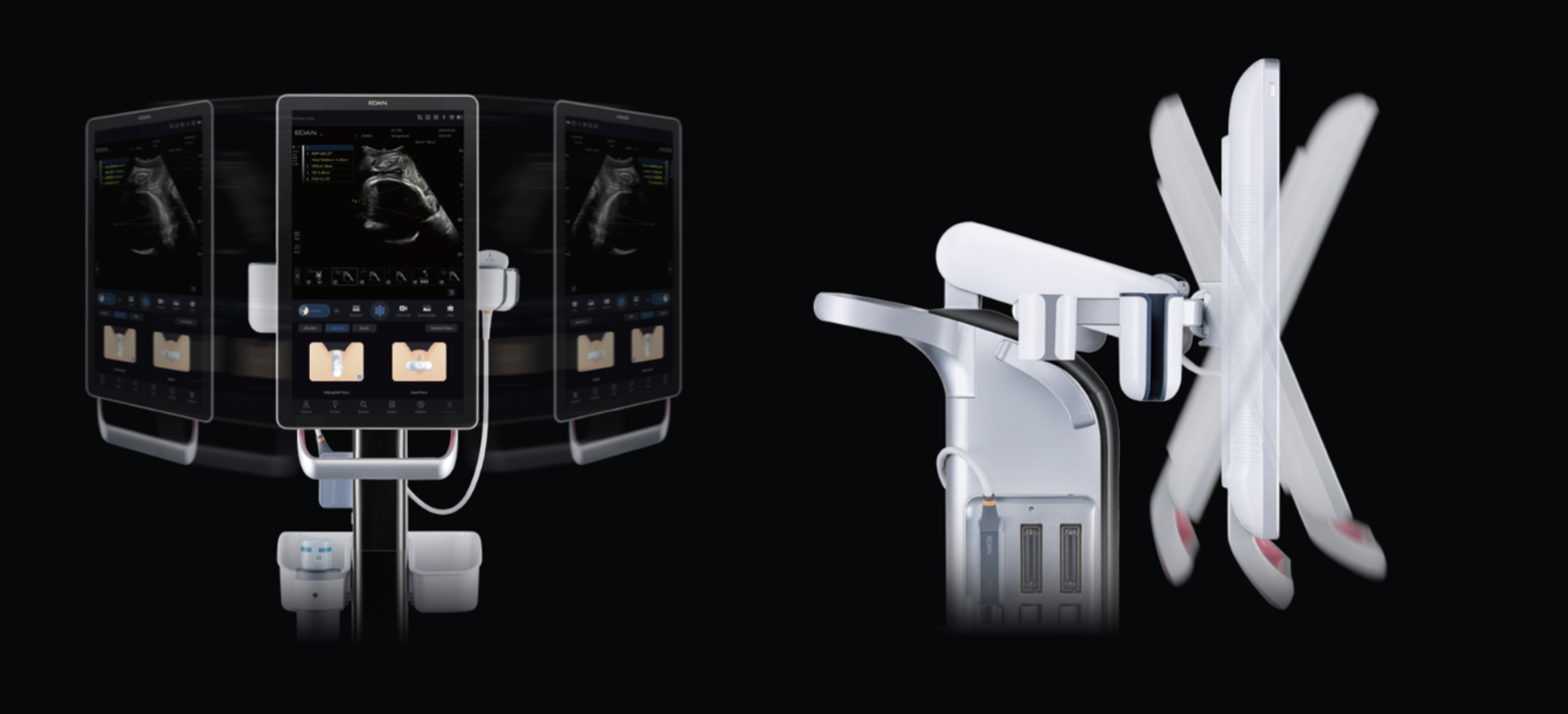 Acclarix GX9F Ultrasound  - 4