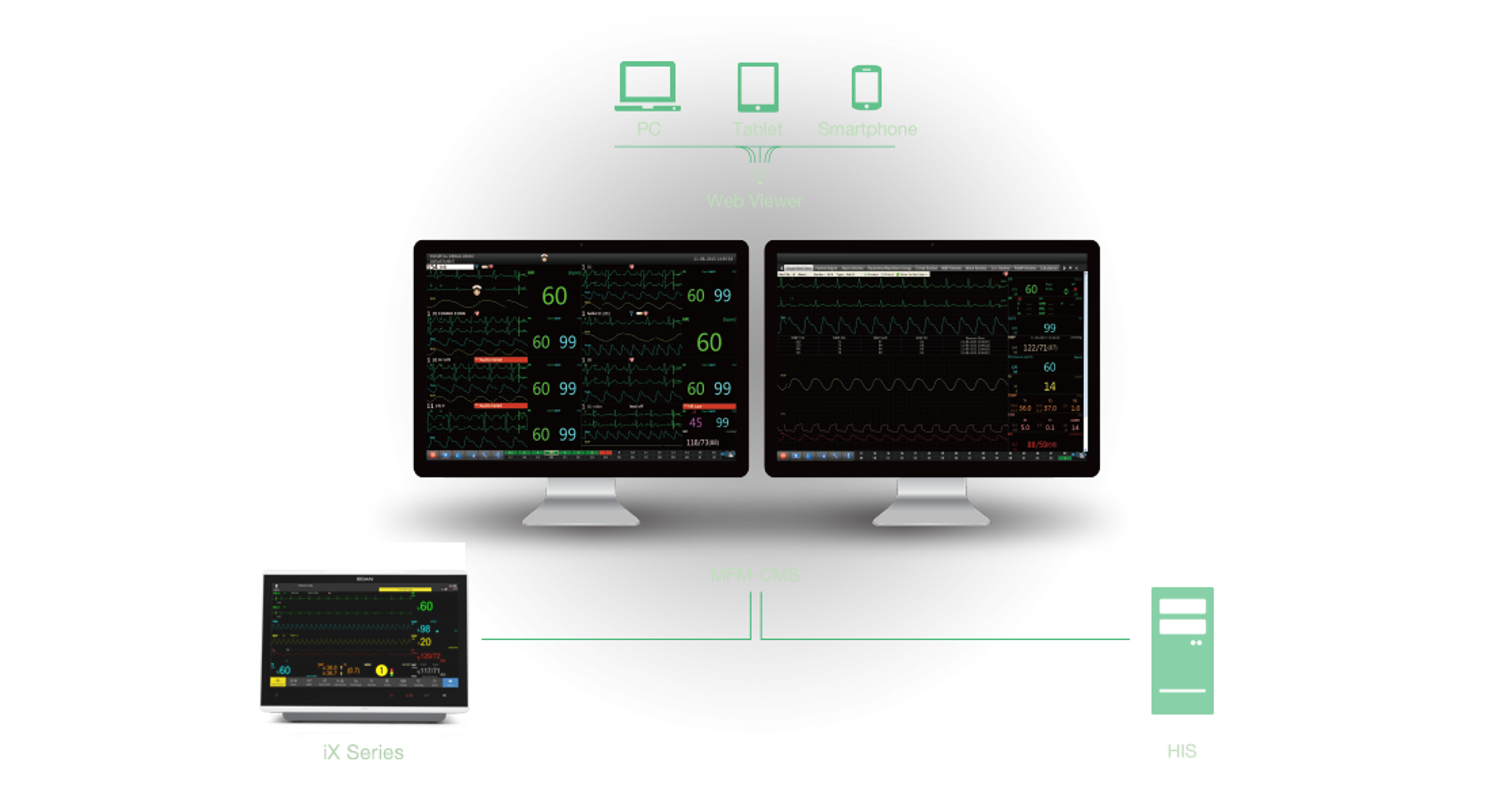 Edan iX Series - 3