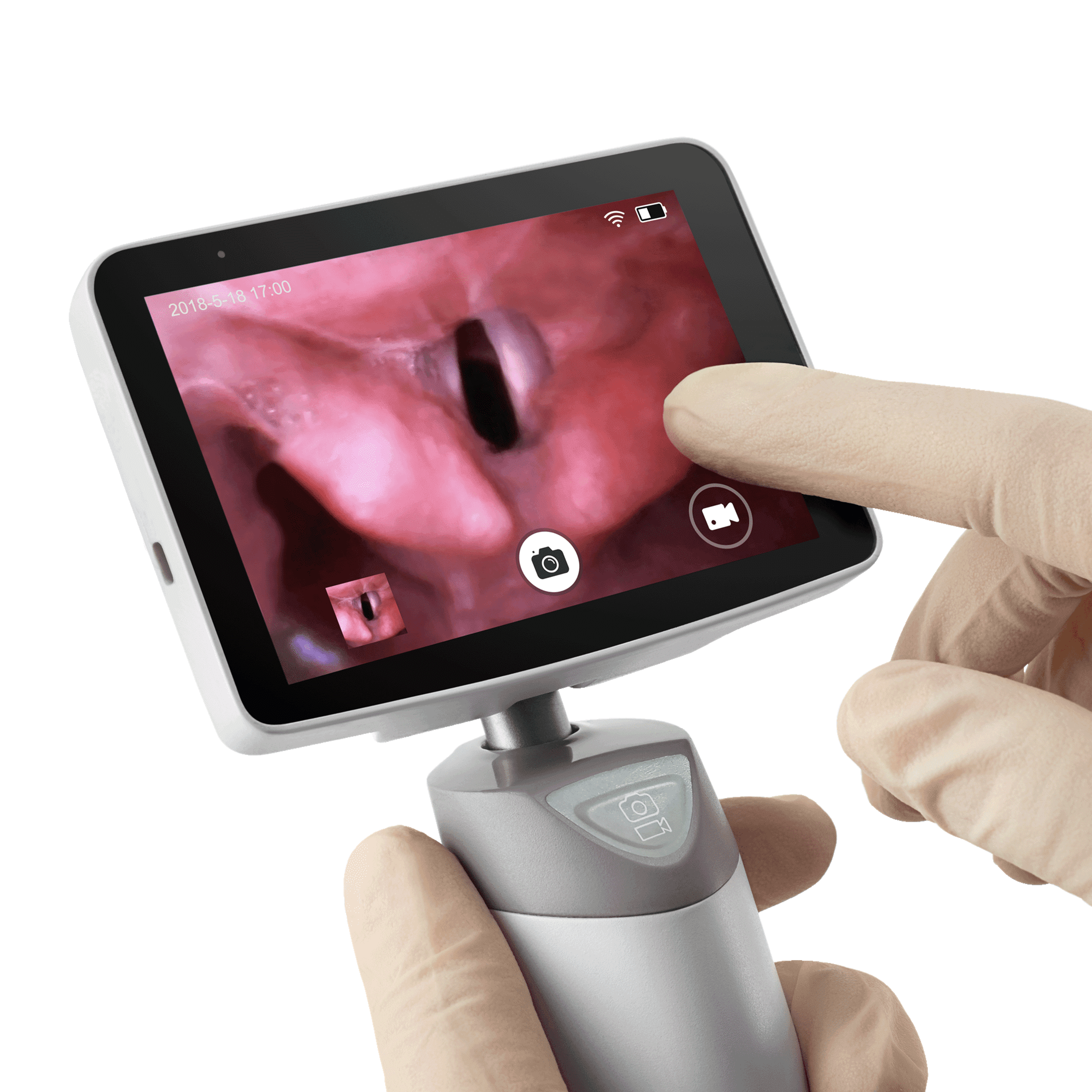 Penlon Diamond Video Laryngoscope - 3