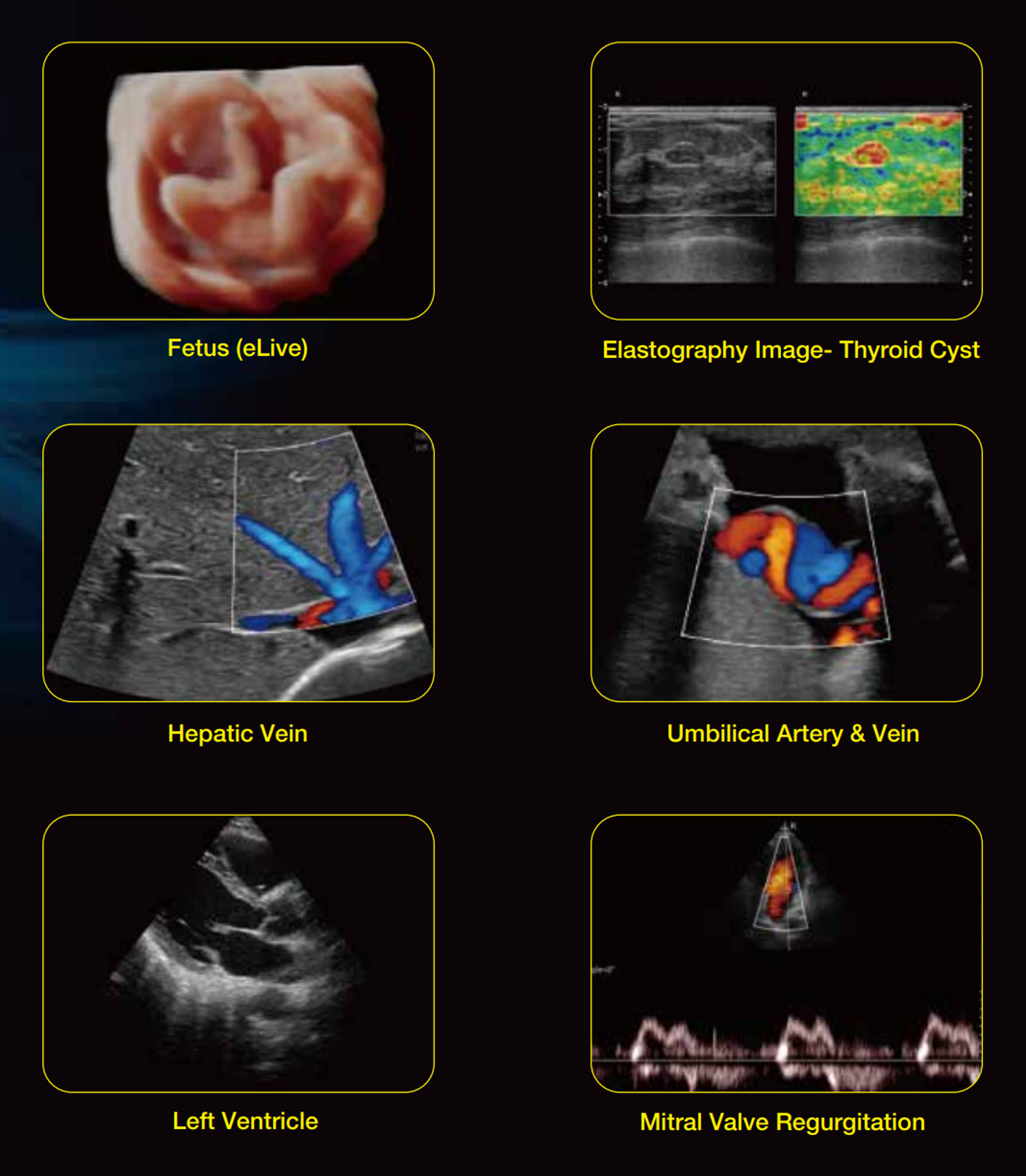 Edan Acclarix LX9 Ultrasound - 4