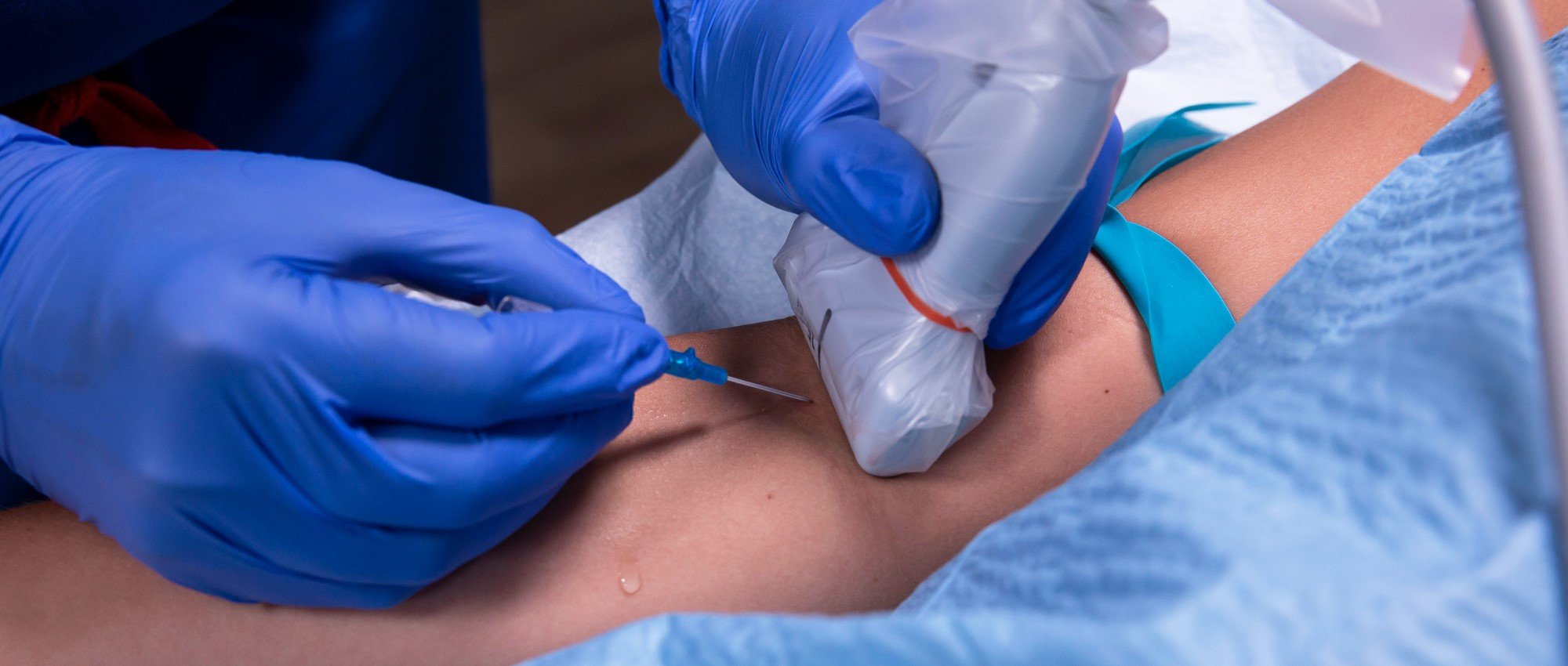 Envision™ Ultrasound Probe Covers & Scanning Pads