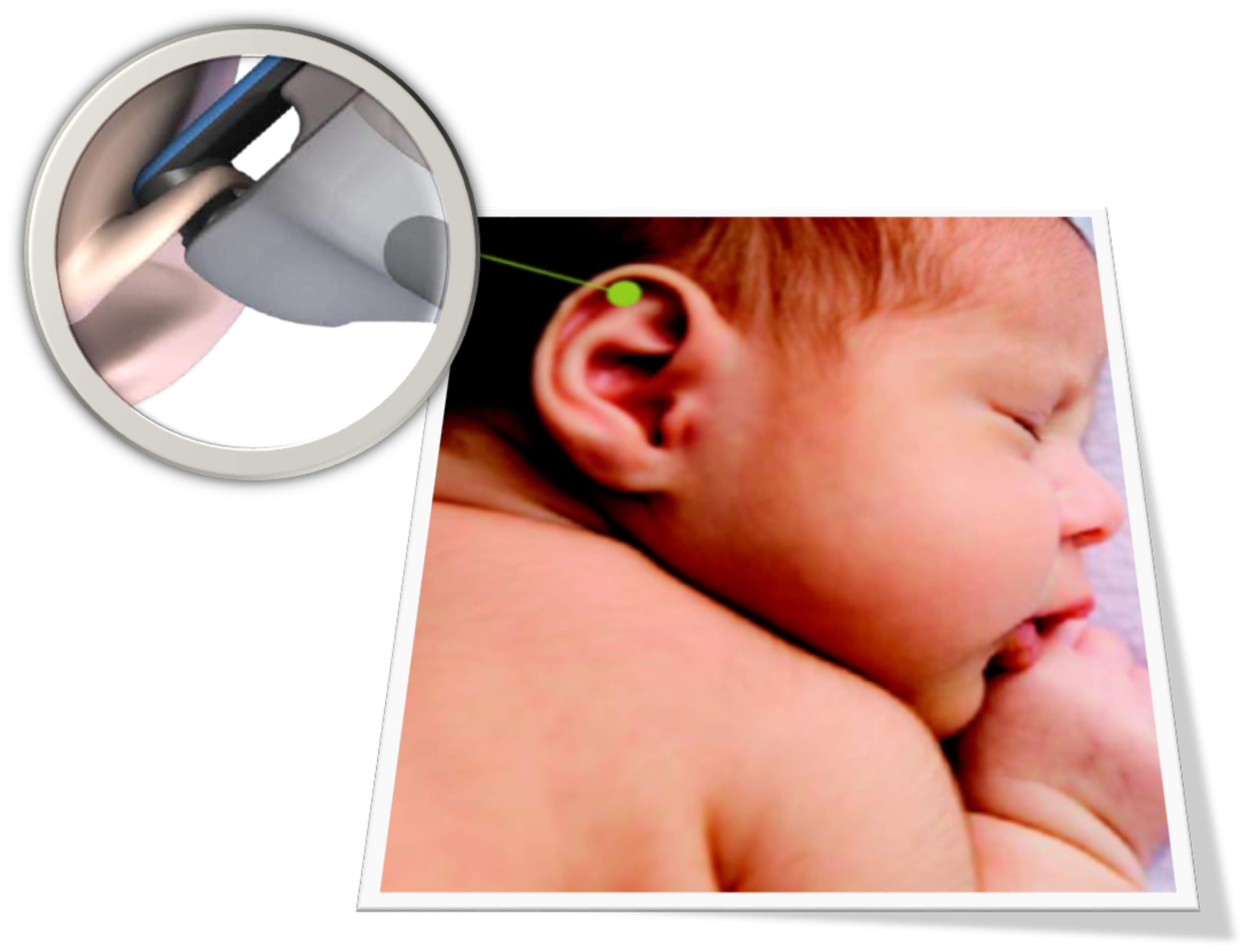 Bilicare Bilirubin Monitor - 2