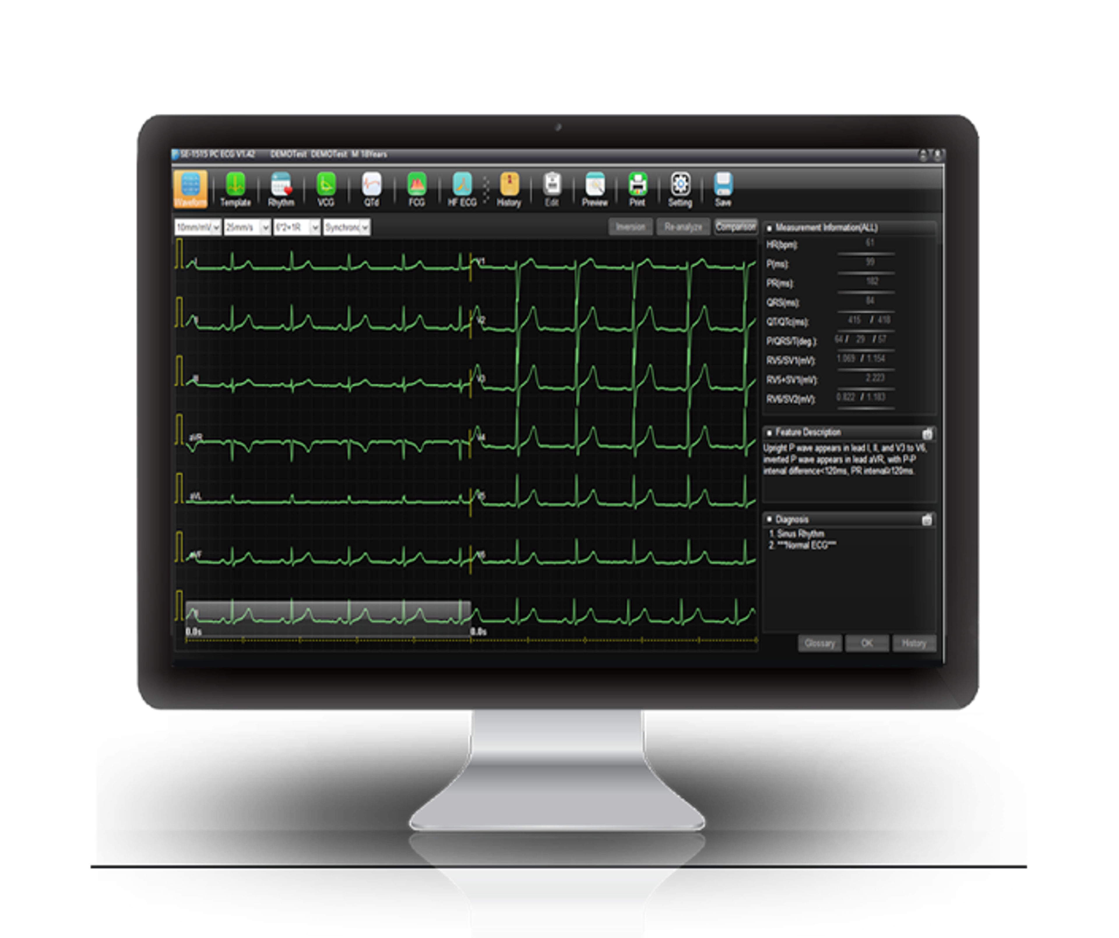 Edan SE1515 WorkStation - 4