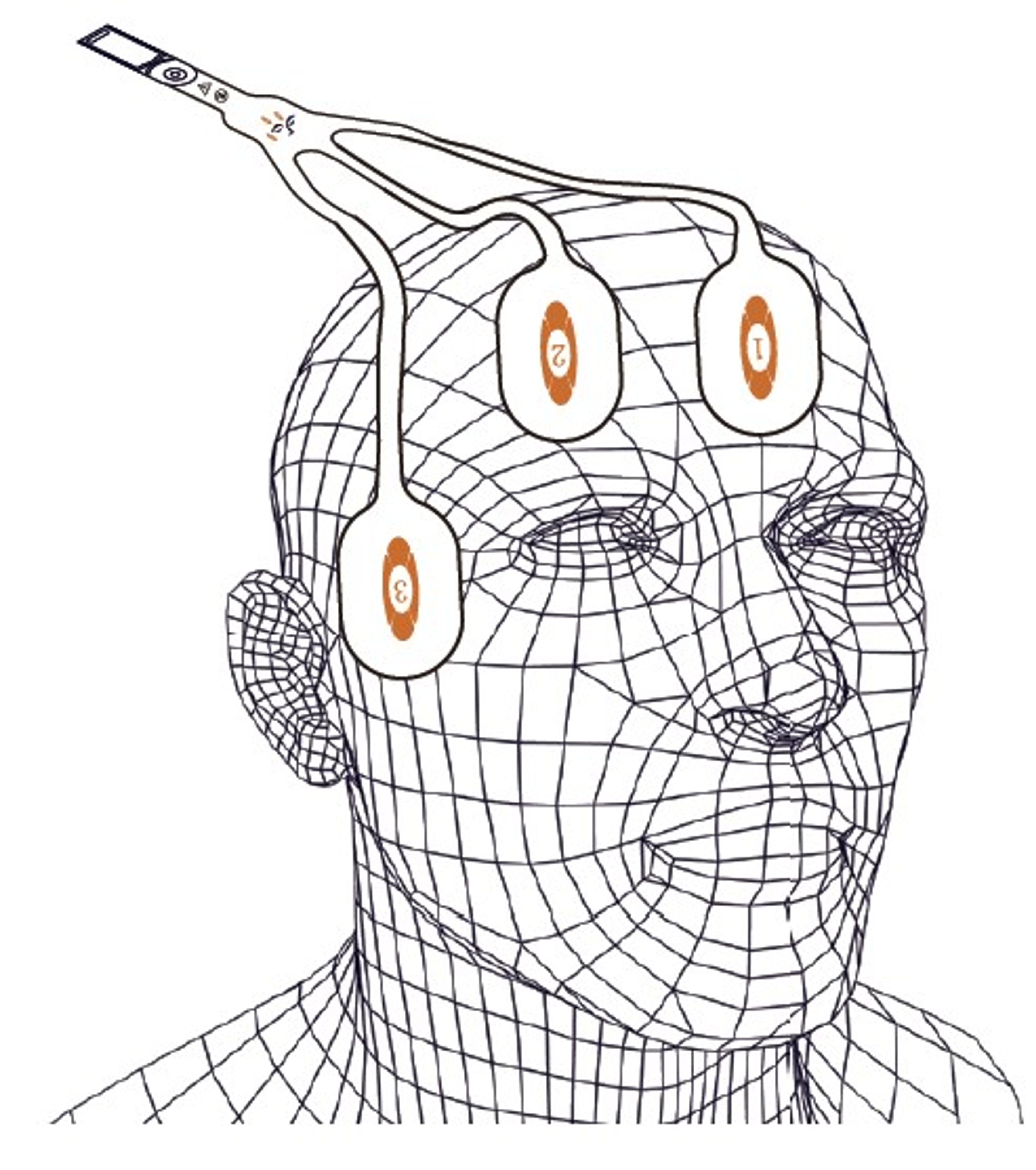 Single Use Disposable EEG Entropy Sensor, 3 separate electrodes (equivalent to M1174413) - 2