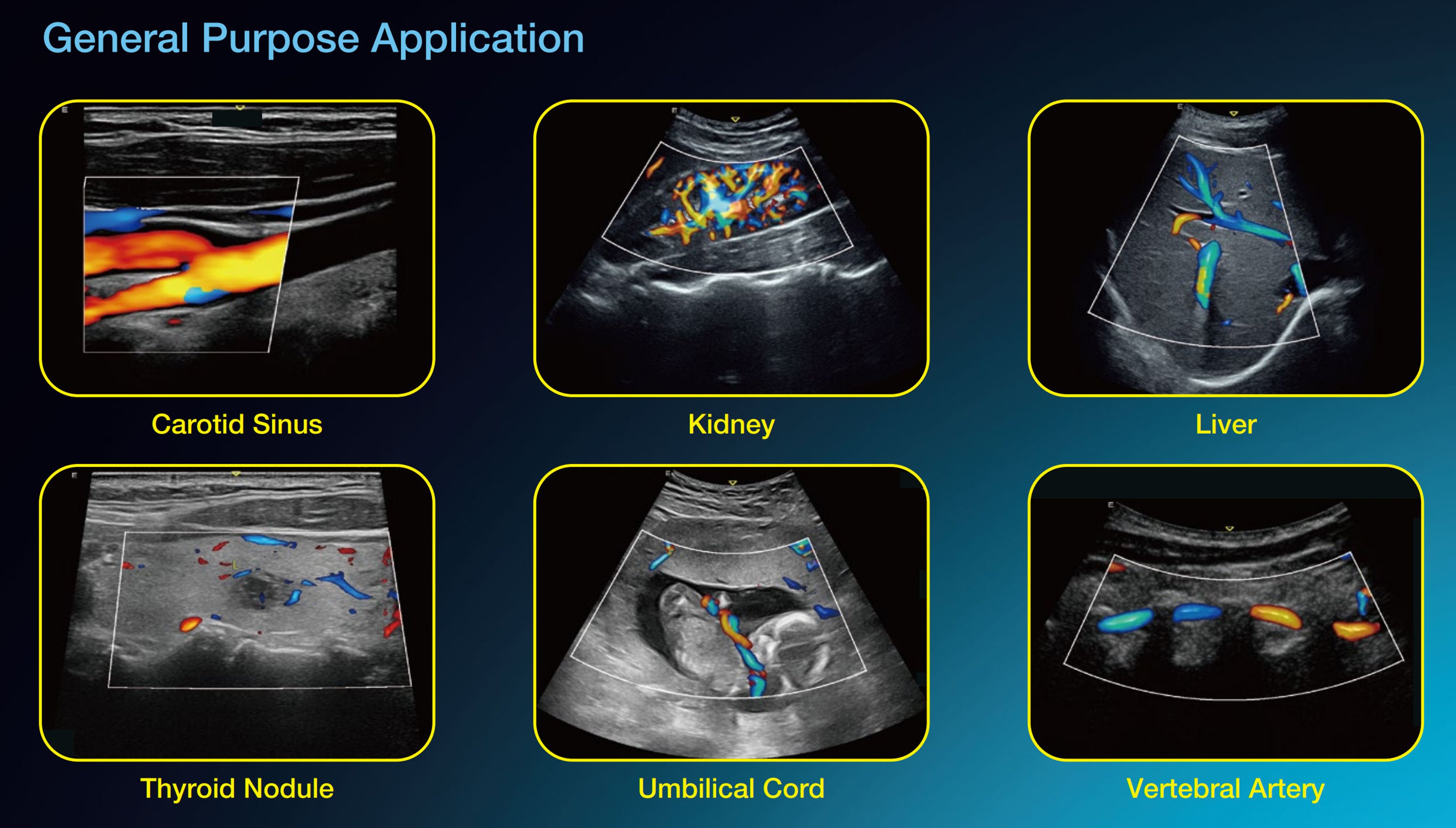 Edan Acclarix AX9 Portable Ultrasound - 2