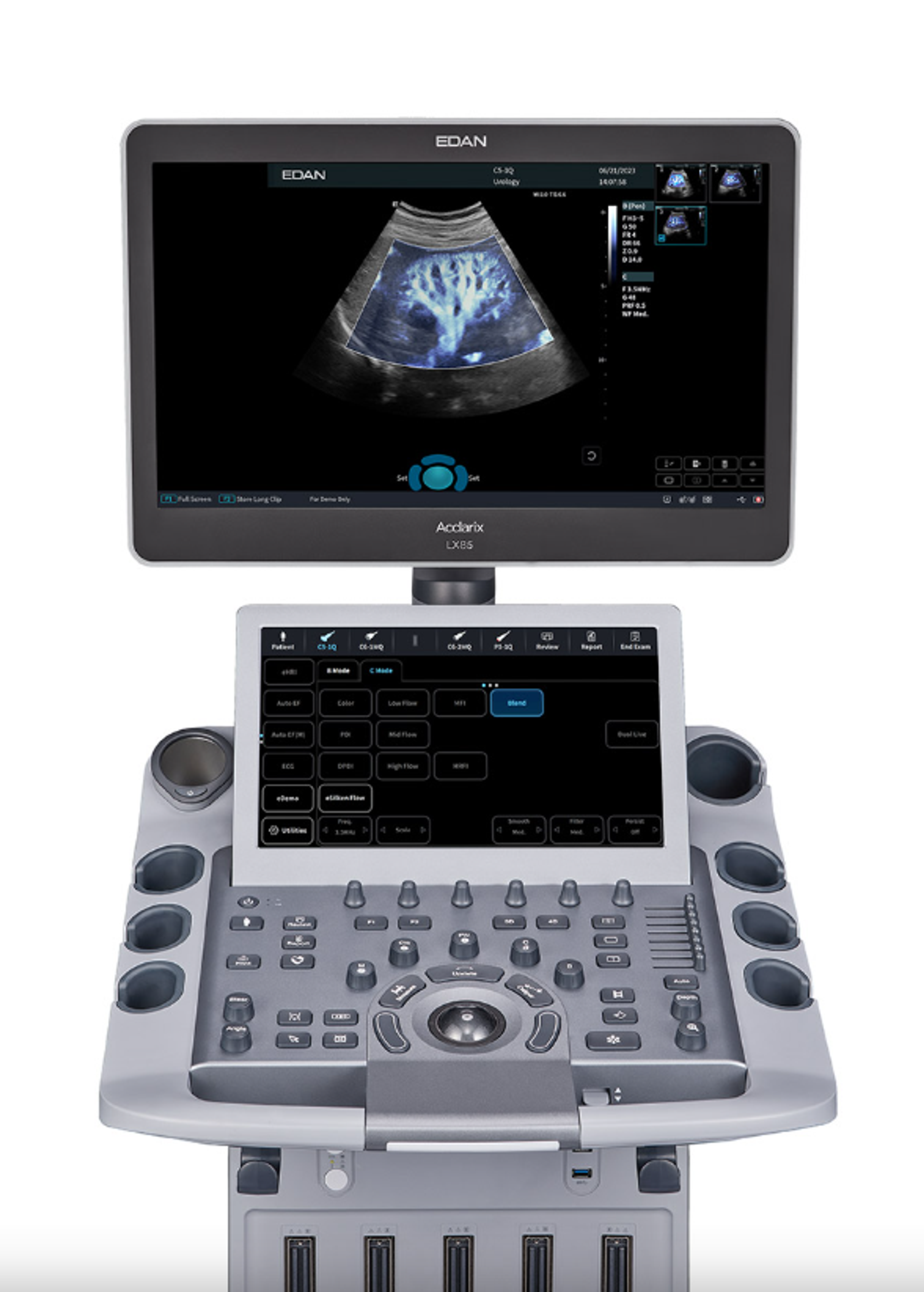 Edan Acclarix LX85 Ultrasound - 3