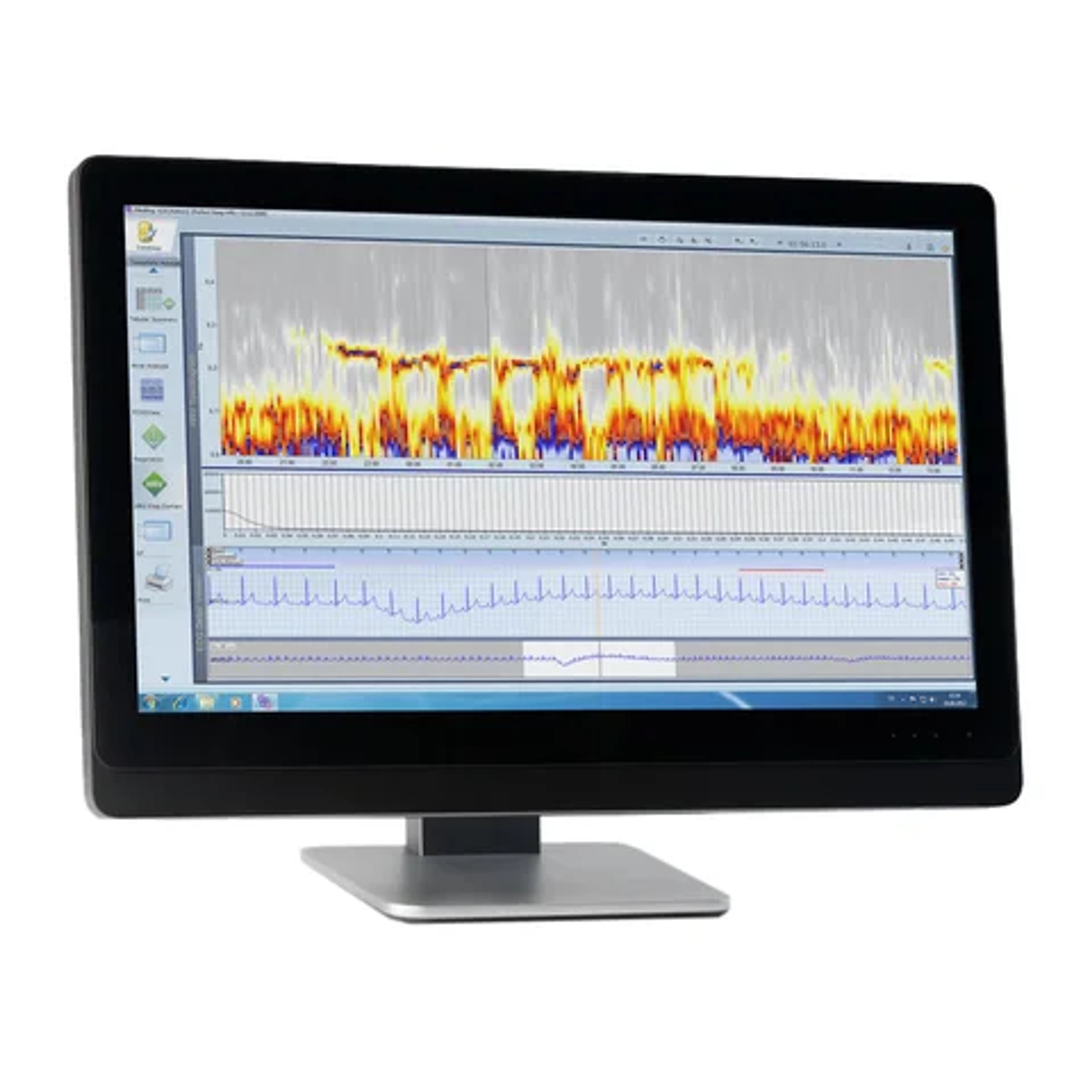 Holter Analysis
