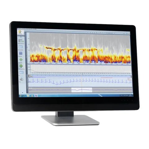 Holter Analysis