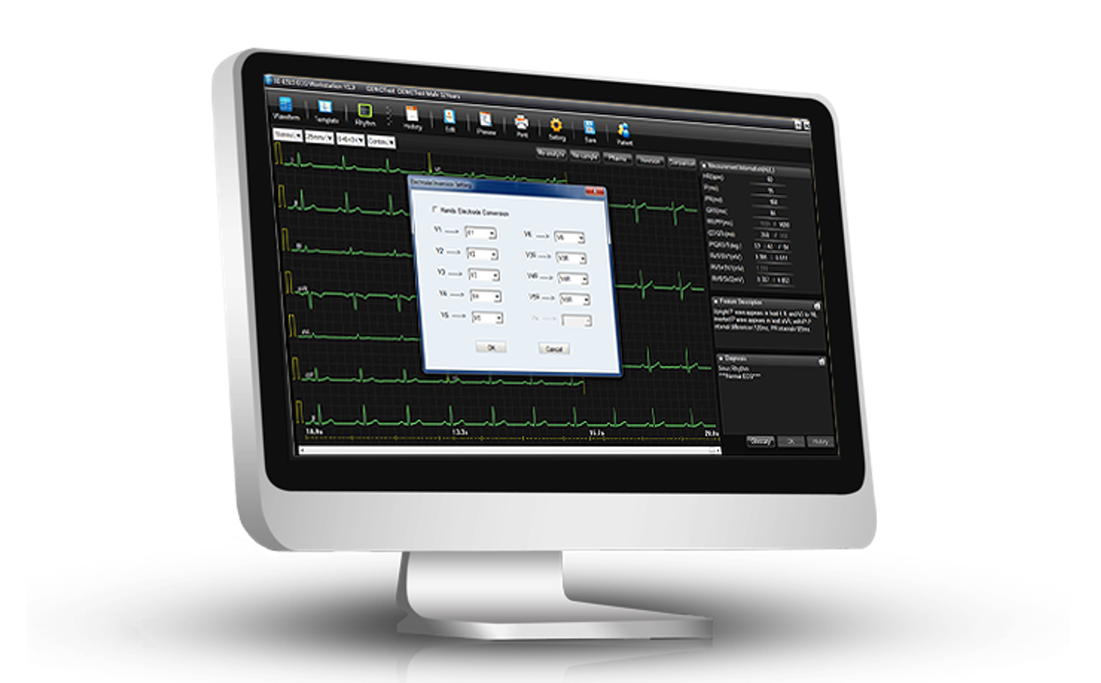 Edan SE1515 WorkStation - 2