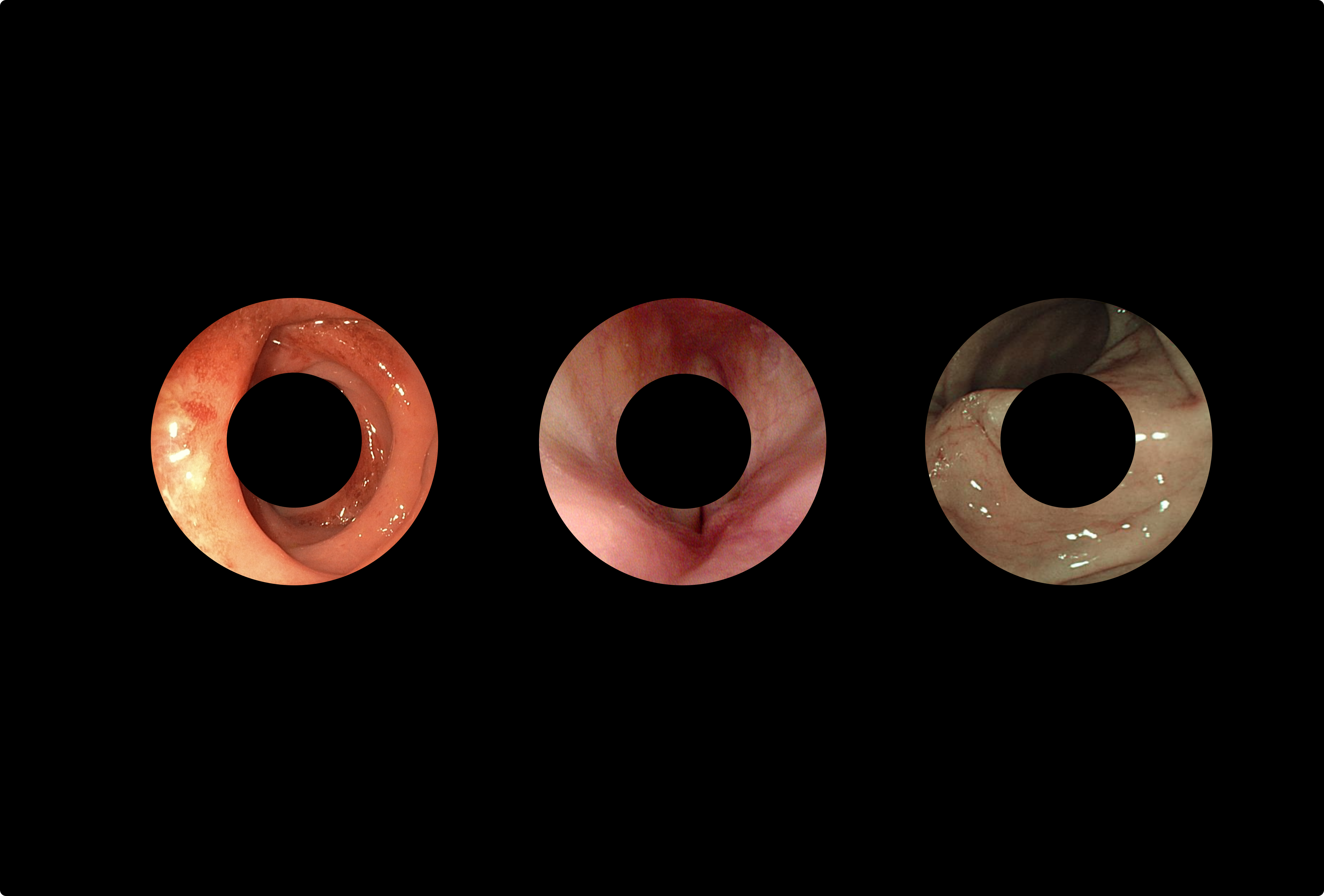 Orifice Oriented Ontologies