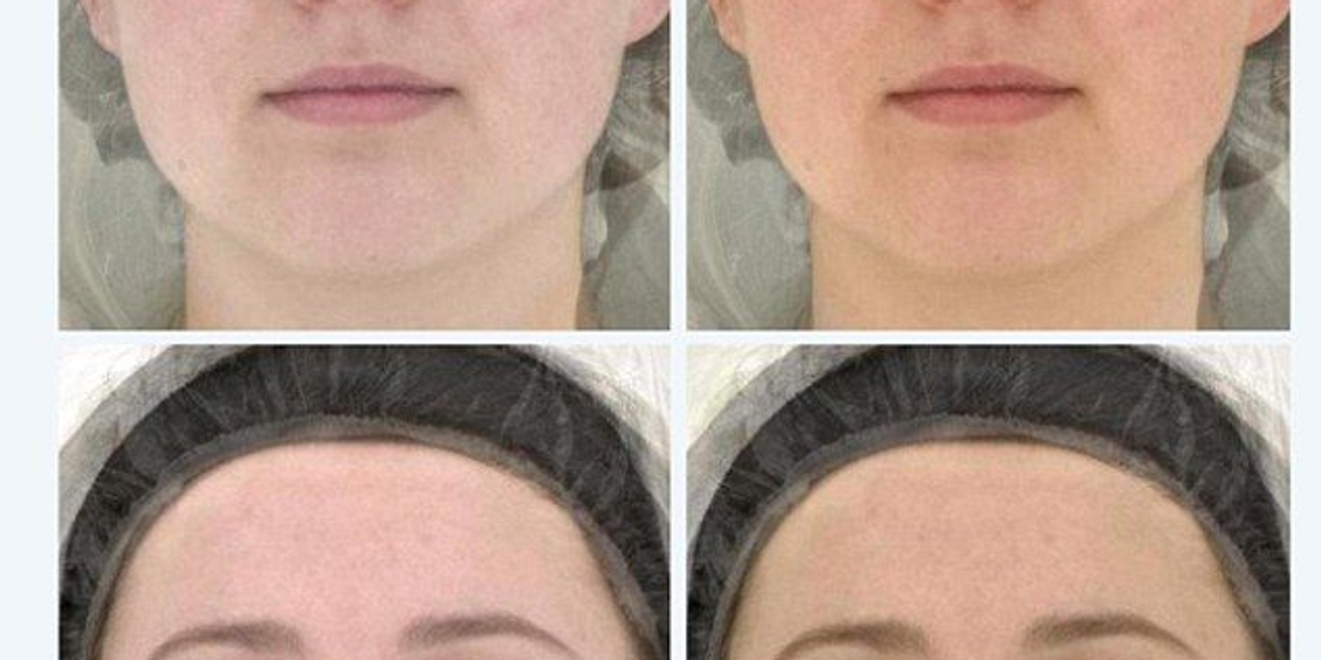 Beta-Carotene & Lycopene - Detailed Look Maxxing Protocol Overview