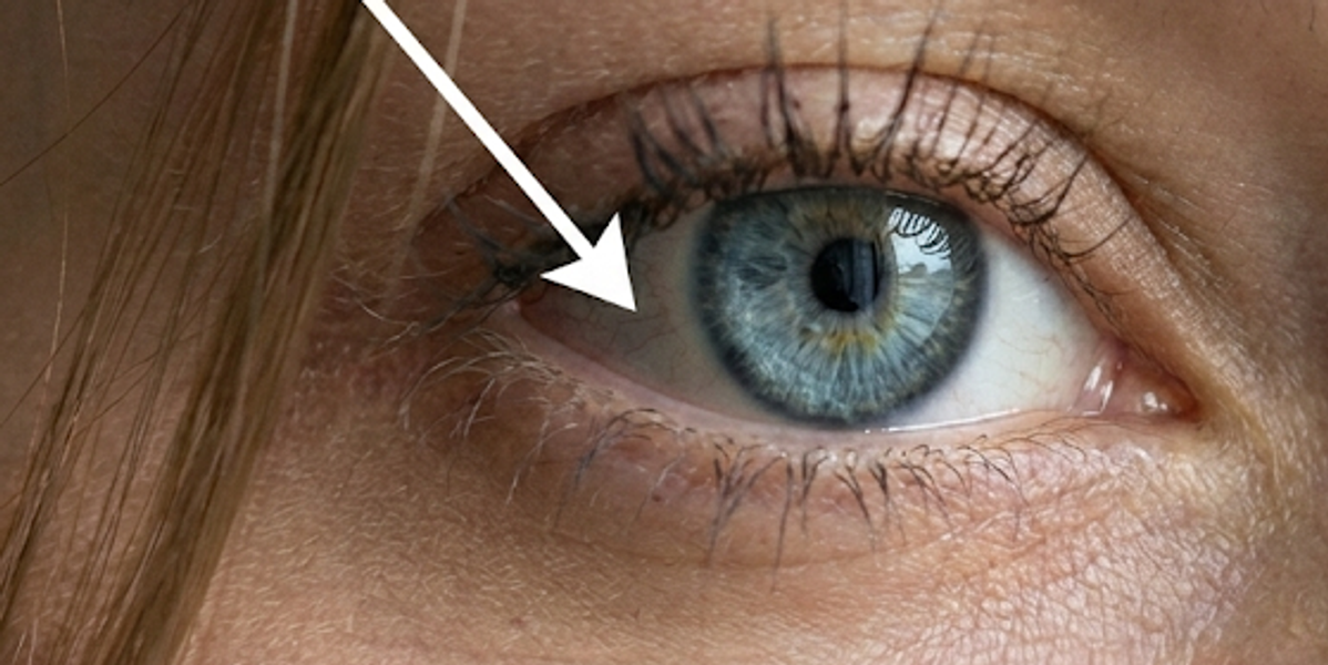 Scleral White Attractiveness  - Detailed Look Maxxing Protocol Overview