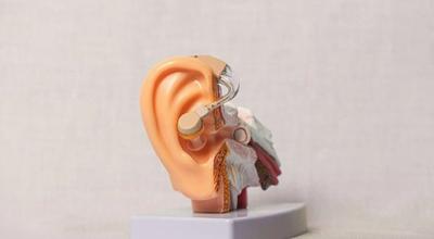 Colesteatoma en el oido medio