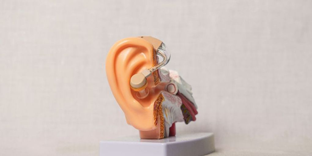 Colesteatoma en el oido medio