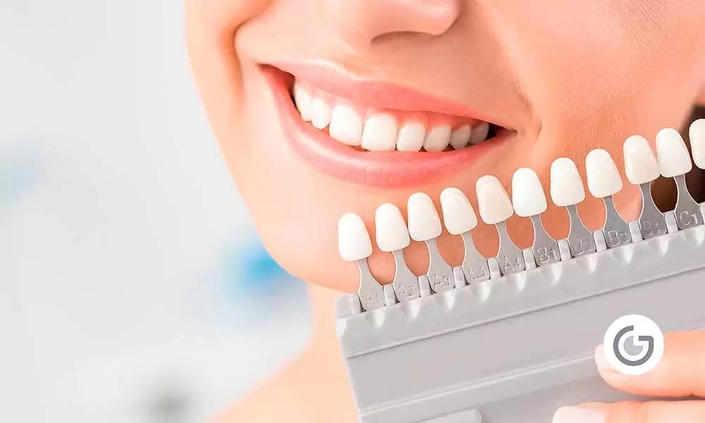 Blanqueamiento Dental
