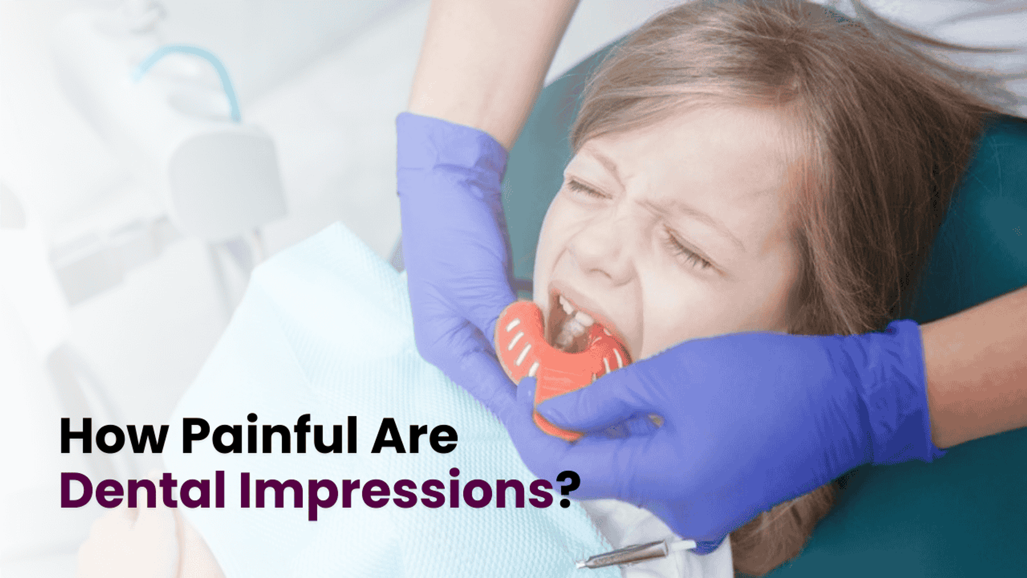 How Painful Are Dental Impressions? What You Need to Know