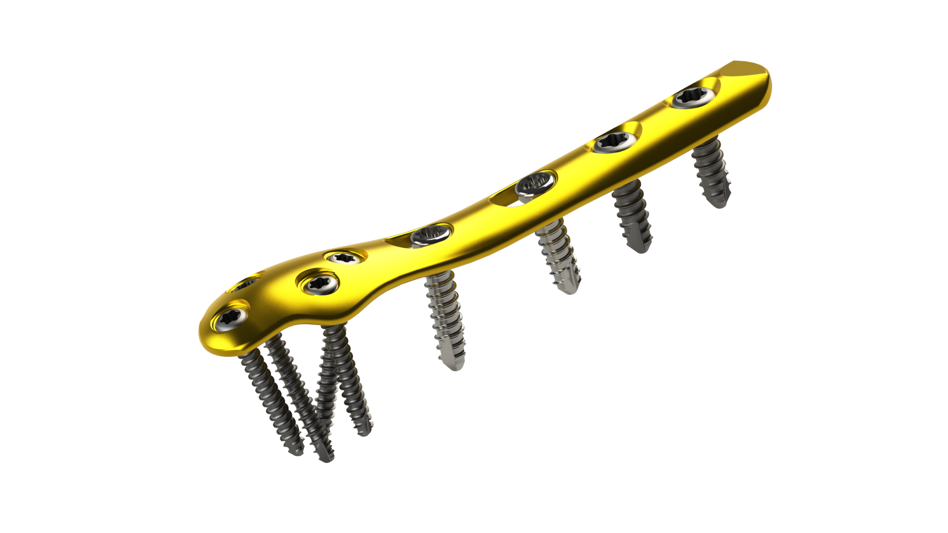 Distal Fibula Plating System