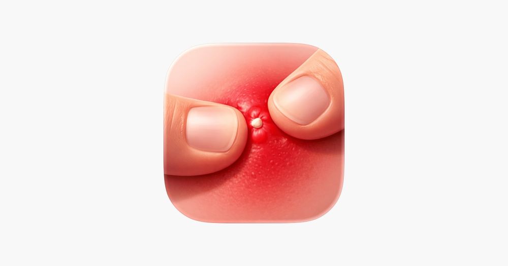 Pimple Pop 3D Pimple Pop 3D