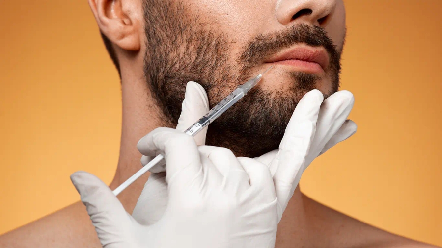 Beard Transplant in Dubai