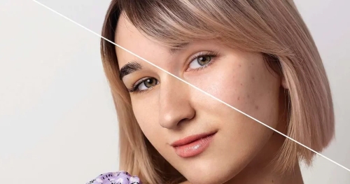 Skin Lightening Treatment