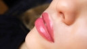 Why Is Pink Lips Laser Treatment More Trendy than You Think?