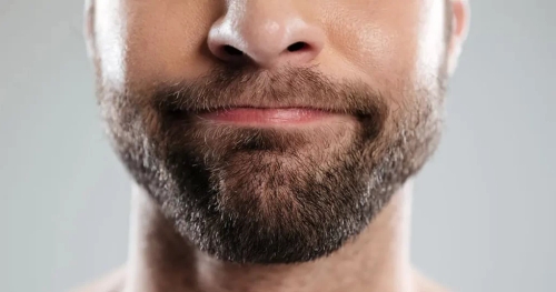 Beard Transplant
