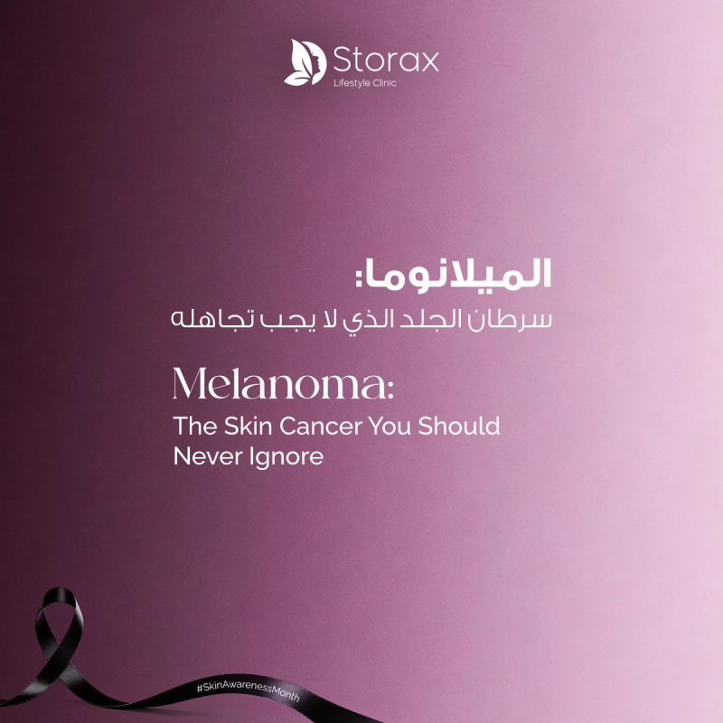 Melanoma: The Skin Cancer You Should Never Ignore
