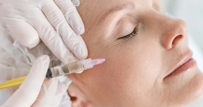 Mesotherapy