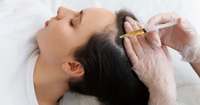 Maxxi PRP Treatment