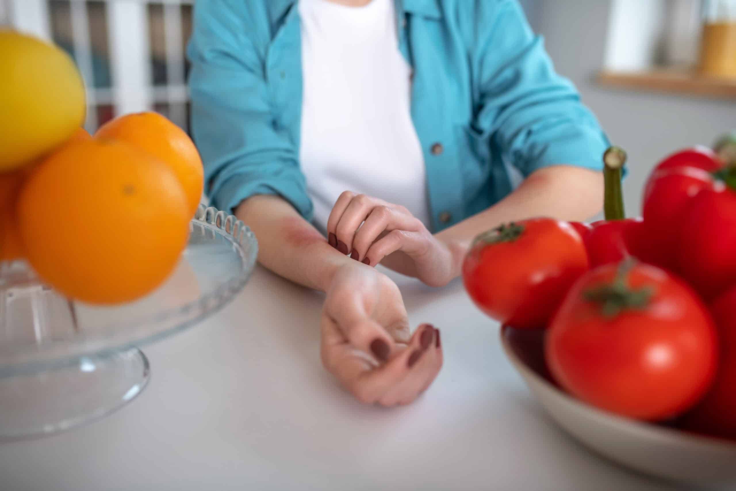 This Low-Histamine Food List Might Help Ease Your Allergies