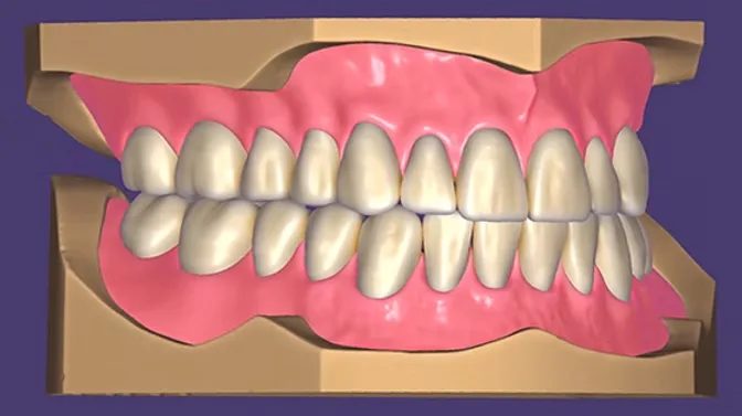 Exocad Premium Denture Tooth Library Ingrandisci immagine