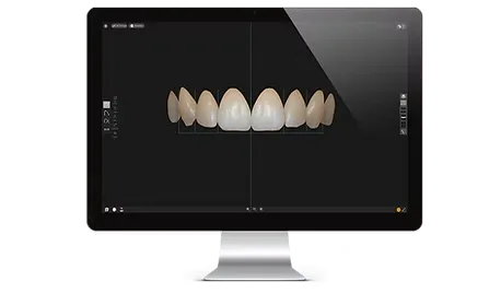 Smile Designer Ingrandisci immagine