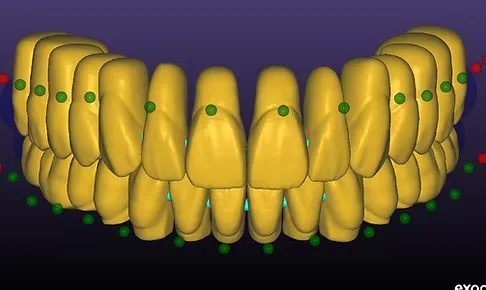 Exocad Premium Tooth Library Görseli büyüt