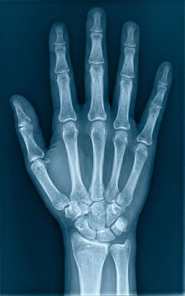 Mano