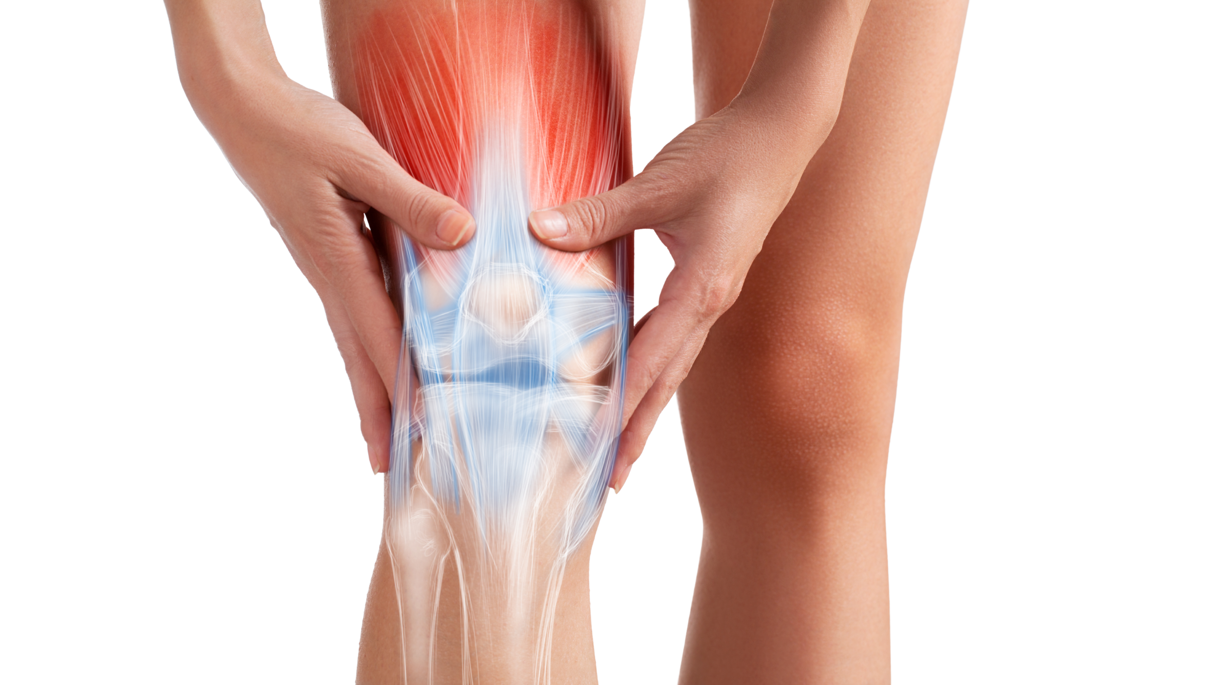 Arthritis Leads to Knee Replacement