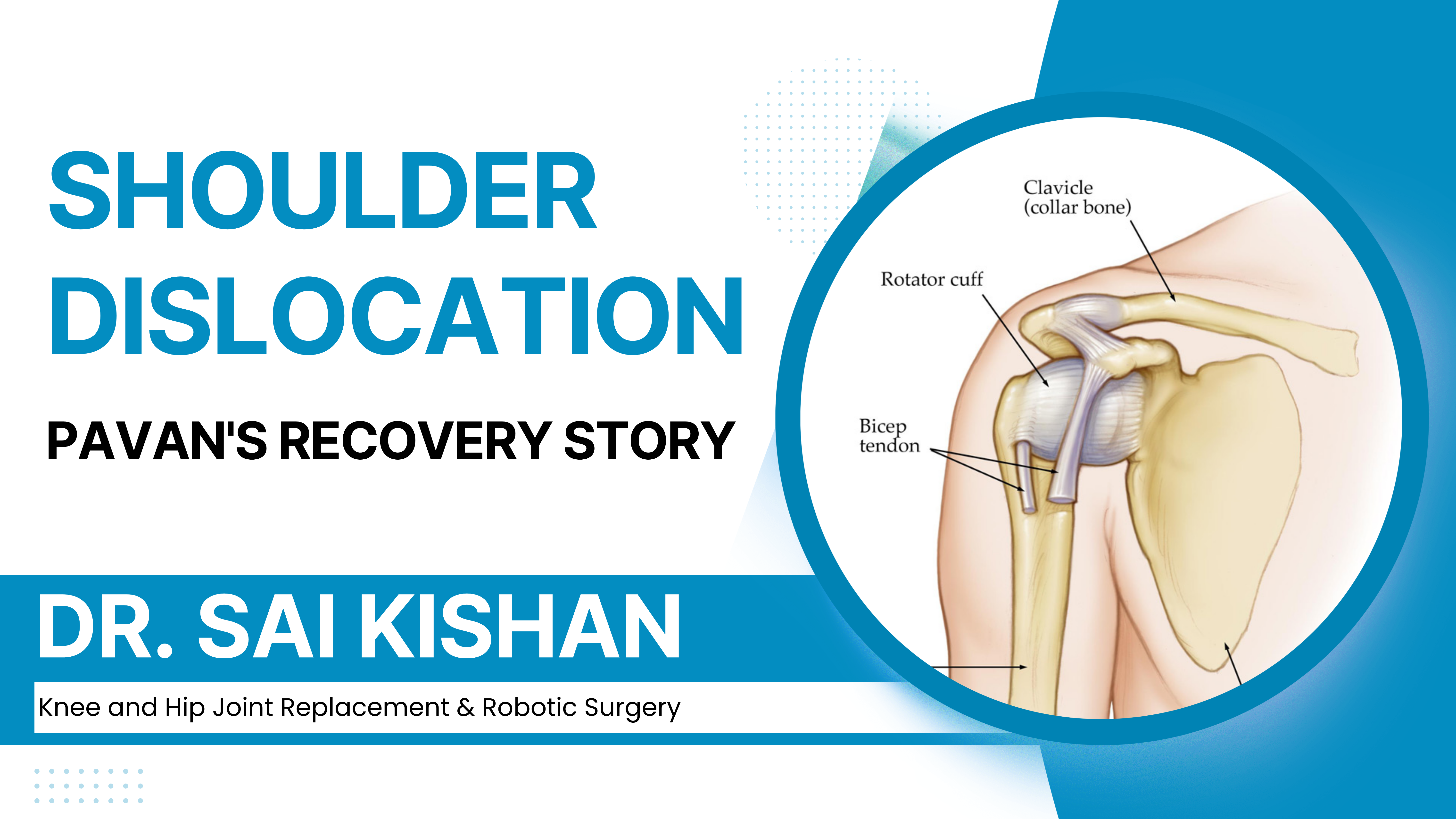 Recovering From a Shoulder Dislocation