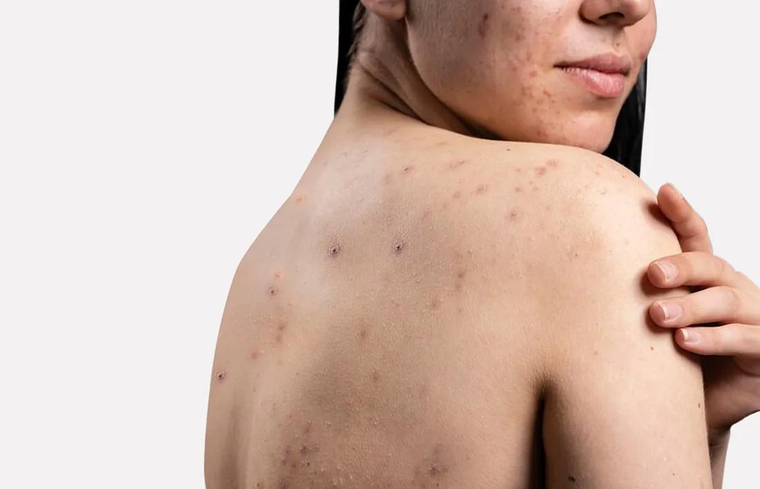 Harsh effects of Waxing