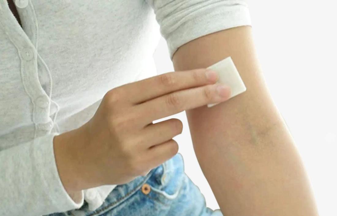 A woman getting allergic redness due to olive oil