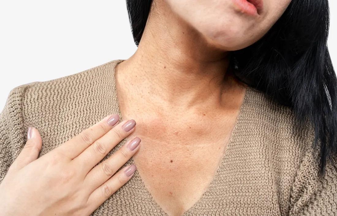 Dark patches on skin