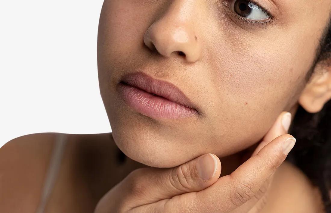Dead skin cells Build up